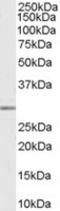 Matrix Metallopeptidase 7 antibody, TA302676, Origene, Western Blot image 