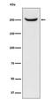 Nuclear Mitotic Apparatus Protein 1 antibody, M02018-1, Boster Biological Technology, Western Blot image 