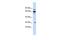 Defective In Cullin Neddylation 1 Domain Containing 3 antibody, GTX45583, GeneTex, Western Blot image 
