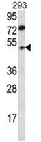 Abhydrolase Domain Containing 2 antibody, AP50026PU-N, Origene, Western Blot image 