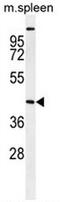 Serine/Threonine Kinase 32A antibody, AP54075PU-N, Origene, Western Blot image 
