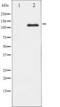Platelet Derived Growth Factor Receptor Beta antibody, TA325770, Origene, Western Blot image 