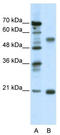 Cholinergic Receptor Nicotinic Beta 3 Subunit antibody, TA330428, Origene, Western Blot image 