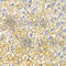 FAS antibody, A0461, ABclonal Technology, Immunohistochemistry paraffin image 