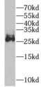Oxidized Low Density Lipoprotein Receptor 1 antibody, FNab05990, FineTest, Western Blot image 