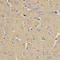 Mevalonate Kinase antibody, LS-C334003, Lifespan Biosciences, Immunohistochemistry frozen image 