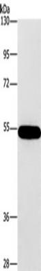 Carnosine Dipeptidase 1 antibody, TA349814, Origene, Western Blot image 