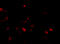 Junctophilin 3 antibody, A08160, Boster Biological Technology, Immunofluorescence image 