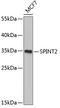 Serine Peptidase Inhibitor, Kunitz Type 2 antibody, GTX64596, GeneTex, Western Blot image 