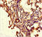 ATP Binding Cassette Subfamily G Member 8 antibody, LS-C676896, Lifespan Biosciences, Immunohistochemistry paraffin image 