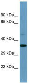 Speedy/RINGO Cell Cycle Regulator Family Member E1 antibody, TA344572, Origene, Western Blot image 