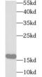 Ubiquitin-conjugating enzyme E2 B antibody, FNab09164, FineTest, Western Blot image 