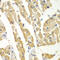 Histamine N-Methyltransferase antibody, 15-026, ProSci, Immunohistochemistry paraffin image 