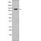 ABL Proto-Oncogene 1, Non-Receptor Tyrosine Kinase antibody, PA5-64565, Invitrogen Antibodies, Western Blot image 