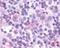 C-C Motif Chemokine Receptor 9 antibody, NLS958, Novus Biologicals, Immunohistochemistry frozen image 
