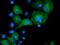 DnaJ Heat Shock Protein Family (Hsp40) Member A2 antibody, MA5-25236, Invitrogen Antibodies, Immunocytochemistry image 
