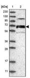 Neuroepithelial Cell Transforming 1 antibody, NBP2-13653, Novus Biologicals, Western Blot image 