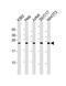 Proteasome Subunit Beta 3 antibody, M11330, Boster Biological Technology, Western Blot image 