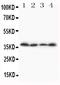 Stimulated by retinoic acid gene 8 protein homolog antibody, PA1685, Boster Biological Technology, Western Blot image 