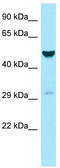 Galactokinase 2 antibody, TA331254, Origene, Western Blot image 