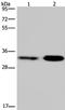 Cyclin Dependent Kinase 5 antibody, TA323961, Origene, Western Blot image 