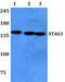 Stromal Antigen 3 antibody, PA5-75297, Invitrogen Antibodies, Western Blot image 