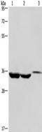 Inhibitor Of Growth Family Member 2 antibody, TA349354, Origene, Western Blot image 