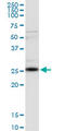 Clathrin Light Chain A antibody, LS-C196937, Lifespan Biosciences, Western Blot image 