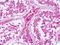 Protein Tyrosine Phosphatase Receptor Type E antibody, NLS6799, Novus Biologicals, Immunohistochemistry paraffin image 