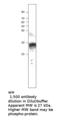 Cyclin Dependent Kinase Inhibitor 1B antibody, MBS540539, MyBioSource, Western Blot image 