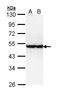 Serine/Threonine Kinase 40 antibody, LS-C186205, Lifespan Biosciences, Western Blot image 