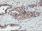 HLCS antibody, M02377, Boster Biological Technology, Immunohistochemistry paraffin image 