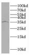 Syndecan Binding Protein 2 antibody, FNab08457, FineTest, Western Blot image 