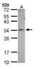 Peroxisomal Biogenesis Factor 26 antibody, TA308062, Origene, Western Blot image 
