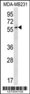 Zinc Finger Protein 506 antibody, 56-635, ProSci, Western Blot image 