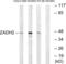 Zinc Binding Alcohol Dehydrogenase Domain Containing 2 antibody, abx015025, Abbexa, Western Blot image 