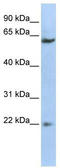 SUFU Negative Regulator Of Hedgehog Signaling antibody, TA345193, Origene, Western Blot image 
