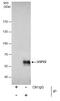 Ubiquitin carboxyl-terminal hydrolase 22 antibody, PA5-31634, Invitrogen Antibodies, Immunoprecipitation image 