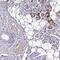 Chromosome 11 Open Reading Frame 91 antibody, NBP2-14706, Novus Biologicals, Immunohistochemistry paraffin image 
