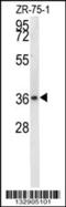 Nitrilase 1 antibody, 56-814, ProSci, Western Blot image 