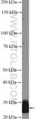Complement Factor D antibody, 26050-1-AP, Proteintech Group, Enzyme Linked Immunosorbent Assay image 