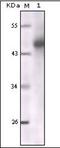 Keratin antibody, orb89384, Biorbyt, Western Blot image 