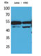 Hepatocyte Nuclear Factor 4 Alpha antibody, STJ96691, St John