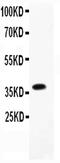 Fc Fragment Of IgE Receptor II antibody, PA5-79242, Invitrogen Antibodies, Western Blot image 
