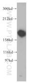 UDP-Glucose Glycoprotein Glucosyltransferase 1 antibody, 14170-1-AP, Proteintech Group, Western Blot image 
