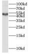 Matrix metalloproteinase-28 antibody, FNab05243, FineTest, Western Blot image 