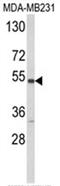 Cytochrome P450 Family 2 Subfamily A Member 13 antibody, AP17964PU-N, Origene, Western Blot image 