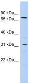 Solute carrier family 23 member 2 antibody, TA333947, Origene, Western Blot image 