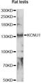 Potassium Calcium-Activated Channel Subfamily U Member 1 antibody, LS-C749949, Lifespan Biosciences, Western Blot image 