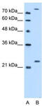 Protein-L-Isoaspartate (D-Aspartate) O-Methyltransferase antibody, TA346739, Origene, Western Blot image 